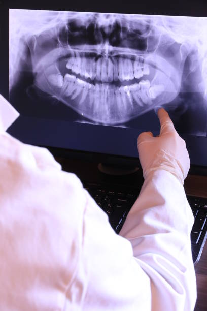 Best Knocked-Out Tooth (Avulsed Tooth) Treatment in North Lakeville, MA
